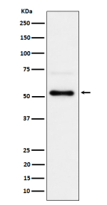 Phospho-CHK1 Antibody 293T WB. Western blot analysis of human 293T cell lysate treated with Calyculin A using phospho-CHK1 antibody detecting CHK1 phosphorylated at Ser280, clone 31C46. A band is observed at approximately 54 kDa, consistent with the predicted molecular weight of CHK1. Detection under phosphatase inhibition conditions supports phosphorylation-dependent regulation of CHK1 and signaling cross-talk with cellular pathways.