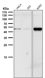 All lanes use the Phospho-CHK1 (pSer280) Antibody at 1:1000 dilution for 1 hour at room temperature.