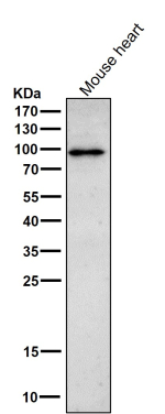 Phospho-Beta Catenin (pThr41/pSer45) Antibody Heart WB. Western blot testing of mouse heart tissue lysate with the Phospho-Beta Catenin (pThr41/pSer45) antibody at 1:1000 dilution for 1 hour at room temperature.