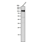 All lanes use the USP5 antibody at 1:1K dilution for 1 hour at room temperature. Predicted molecular weight ~96 kDa.