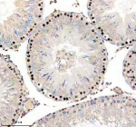 Immunohistochemical staining of PARP11 using anti-PARP11 antibody. PARP11 was detected in a paraffin-embedded section of rat testis tissue. Heat mediated antigen retrieval was performed in EDTA buffer (pH 8.0, epitope retrieval solution). The tissue section was blocked with 10% goat serum. The tissue section was then incubated with 2 ug/ml rabbit anti-PARP11 antibody overnight at 4oC. Peroxidase Conjugated Goat Anti-rabbit IgG was used as secondary antibody and incubated for 30 minutes at 37oC. The tissue section was developed using an HRP secondary and DAB substrate.