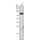 All lanes use the Phospho-CRMP2 (pThr514) antibody at 1:6000 dilution for 1 hour at room temperature. Phospho-CRMP2 (~62 kDa predicted) was detected as a major band at ~63-65 kDa, consistent with phosphorylation at GSK3Î²/CDK5-regulated residues Thr509, Thr514, and Ser522, which slightly retard electrophoretic mobility relative to total CRMP2.