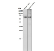 All lanes use the Phospho-CRMP2 (pThr514) antibody at 1:6000 dilution for 1 hour at room temperature. Phospho-CRMP2 (~62 kDa predicted) was detected as a major band at ~63-65 kDa, consistent with phosphorylation at GSK3Î²/CDK5-regulated residues Thr509, Thr514, and Ser522, which slightly retard electrophoretic mobility relative to total CRMP2.