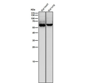 All lanes use the Phospho-CRMP2 (pThr514) antibody at 1:6000 dilution for 1 hour at room temperature. Phospho-CRMP2 (~62 kDa predicted) was detected as a major band at ~63-65 kDa, consistent with phosphorylation at GSK3Î²/CDK5-regulated residues Thr509, Thr514, and Ser522, which slightly retard electrophoretic mobility relative to total CRMP2.