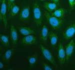 Immunofluorescent staining of RPS3A using anti-RPS3A antibody (green). RPS3A was detected in an immunocytochemical section of Hela cells. Enzyme antigen retrieval was performed using IHC enzyme antigen retrieval reagent for 15 mins. The cells were blocked with 10% goat serum. And then incubated with 5 ug/ml rabbit anti-RPS3A antibody overnight at 4oC. DyLight 488 Conjugated Goat Anti-Rabbit IgG was used as secondary antibody at 1:500 dilution and incubated for 30 minutes at 37oC. The section was counterstained with DAPI nuclear stain (blue). Visualize using a fluorescence microscope and filter sets appropriate for the label used.