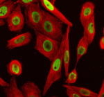Immunofluorescent staining of TERF2IP using anti-TERF2IP antibody (red) and anti-Beta Tubulin antibody (green). TERF2IP was detected in an immunocytochemical section of SIHA cells. Enzyme antigen retrieval was performed using IHC enzyme antigen retrieval reagent for 15 mins. The cells were blocked with 10% goat serum. And then incubated with 5 ug/ml rabbit anti-TERF2IP antibody and mouse anti-Beta Tubulin antibody overnight at 4oC. DyLight 488 Conjugated Goat Anti-Rabbit IgG and Cy3 Conjugated Goat Anti-Mouse IgG were used as secondary antibody at 1:500 dilution and incubated for 30 minutes at 37oC. Visualize using a fluorescence microscope and filter sets appropriate for the label used.