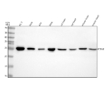 Western blot analysis of RTRAF using anti-RTRAF antibody. Electrophoresis was performed on a 12% SDS-PAGE gel at 80V (Stacking gel) / 120V (Resolving gel) for 2 hours. Lane 1: human PC-3 whole cell lysates, Lane 2: human Hela whole cell lysates, Lane 3: human RT4 whole cell lysates, Lane 4: human SIHA whole cell lysates, Lane 5: rat brain tissue lysates, Lane 6: rat heart tissue lysates, Lane 7: mouse brain tissue lysates, Lane 8: mouse heart tissue lysates. After electrophoresis, proteins were transferred to a nitrocellulose membrane at 150 mA for 50-90 minutes. Blocked the membrane with 5% non-fat milk/TBS for 1.5 hour at RT. The membrane was incubated with rabbit anti-RTRAF antibody at 0.5 ug/ml overnight at 4oC, then washed with TBS-0.1%Tween 3 times with 5 minutes each and probed with a goat anti-rabbit IgG-HRP secondary antibody at a dilution of 1:5000 for 1.5 hour at RT. The signal was developed using an ECL Plus Western Blotting Substrate. A specific band was detected for RTRAF at approximately 28 kDa. The expected molecular weight of RTRAF is ~28 kDa.