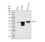 GKAP1 Antibody Human and Rodent Testis WB. Western blot analysis of GKAP1 Antibody using lysates from lane 1: human U2OS cells, lane 2: rat testis and lane 3: mouse testis. A specific band is detected at approximately 42 kDa, consistent with the predicted molecular weight of endogenous GKAP1. An additional lower-molecular-weight band is observed in rat testis, which may represent a tissue-specific isoform or post-translationally processed form of the protein. These results demonstrate cross-species detection of GKAP1 and support the use of GKAP1 Antibody, a G Kinase-Anchoring Protein 1 Antibody, for studies of protein kinase A signaling, testicular biology and intracellular scaffold proteins.