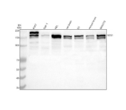 Western blot analysis of SOS1 using anti-SOS1 antibody. Lane 1: human K562 whole cell lysates, Lane 2: human THP-1 whole cell lysates, Lane 3: human HEL whole cell lysates, Lane 4: rat brain tissue lysates, Lane 5: rat C6 whole cell lysates, Lane 6: mouse brain tissue lysates, Lane 7: mouse NIH/3T3 whole cell lysates. After electrophoresis, proteins were transferred to a nitrocellulose membrane at 150 mA for 50-90 minutes. Blocked the membrane with 5% non-fat milk/TBS for 1.5 hour at RT. The membrane was incubated with rabbit anti-SOS1 antibody at 0.5 ug/ml overnight at 4oC, then washed with TBS-0.1%Tween 3 times with 5 minutes each and probed with a goat anti-rabbit IgG-HRP secondary antibody at a dilution of 1:5000 for 1.5 hour at RT. The signal was developed using enhanced chemiluminescent. A doublet is detected at ~150-160 kDa, consistent with phosphorylation-dependent mobility shifts reported for SOS1. K562 shows an additional stronger upper band, likely representing a hyperphosphorylated SOS1 species driven by BCR-ABL signaling.