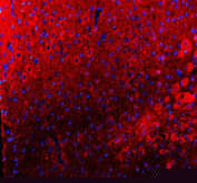 Immunofluorescent staining of TIGAR using anti-TIGAR antibody (red). TIGAR was detected in a paraffin-embedded section of mouse cerebellum tissue. Heat mediated antigen retrieval was performed in EDTA buffer (pH 8.0, epitope retrieval solution). The tissue section was blocked with 10% goat serum. The tissue section was then incubated with 5 ug/ml rabbit anti-TIGAR antibody overnight at 4oC. Cy3 Conjugated Goat Anti-Rabbit IgG was used as secondary antibody at 1:500 dilution and incubated for 30 minutes at 37oC. The section was counterstained with DAPI nuclear stain (blue). Visualize using a fluorescence microscope and filter sets appropriate for the label used.