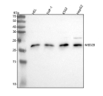 MED28 Antibody in Human Leukemia and Hepatocellular Carcinoma Cells WB. Western blot testing of MED28 Antibody / Mediator complex subunit 28 using lysates from 1) human HEL cells, 2) human THP-1 cells, 3) human K562 cells and 4) human HepG2 cells. The antibody was used at 0.5 ug/ml overnight at 4oC, followed by goat anti-rabbit IgG-HRP at 1:5000 and chemiluminescent detection. A major band is detected at approximately 24 kDa, slightly above the predicted molecular weight of approximately 20 kDa and consistent with the reported migration of MED28. This MED28 Antibody demonstrates detection of Mediator complex subunit 28 in multiple human cell lines.