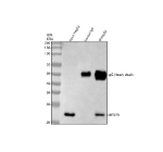 MED28 Antibody Immunoprecipitation from Human HepG2 Cells IP. Immunoprecipitation of MED28 from human HepG2 hepatocellular carcinoma whole cell lysate was performed using MED28 Antibody / Mediator complex subunit 28. Lane 1 contains 30 ug of HepG2 whole cell lysate, lane 2 is the rabbit IgG control and lane 3 contains MED28 immunoprecipitated from 500 ug of HepG2 lysate using 2 ug of antibody. Western blot detection was performed with MED28 Antibody at 0.5 ug/ml followed by goat anti-rabbit IgG-HRP and ECL detection. A major MED28 band is detected at approximately 24 kDa, slightly above its predicted molecular weight of approximately 20 kDa. This MED28 Antibody demonstrates immunoprecipitation of Mediator complex subunit 28 from human HepG2 cells.