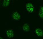 MED28 Antibody in Human U2OS Osteosarcoma Cells IF. Immunofluorescence staining of human U2OS osteosarcoma cells with MED28 Antibody / Mediator complex subunit 28 at 5 ug/ml. Enzyme-mediated antigen retrieval was performed for 15 min, followed by blocking with 10% goat serum. Cells were incubated with the primary antibody overnight at 4oC. Fluoro488-conjugated goat anti-rabbit IgG was used as the secondary antibody at 1:500 for 30 min at 37oC. MED28 staining is predominantly localized to the nuclei. This MED28 Antibody enables visualization of Mediator complex subunit 28 expression and localization in human osteosarcoma cells.