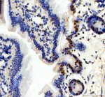 ITPKC Antibody by IHC in mouse colon. Immunohistochemistry of FFPE mouse colon tissue using ITPKC Antibody at 2 ug/ml. Brown immunoreactivity is concentrated in scattered epithelial cells and portions of the glandular structures, with prominent staining near the basal regions of several crypts. Much of the surrounding epithelium exhibits relatively weak staining, while nuclei are counterstained blue-purple. The heterogeneous pattern suggests localized ITPKC immunoreactivity within the intestinal mucosa. Heat-mediated antigen retrieval was performed in EDTA buffer at pH 8.0, followed by overnight primary antibody incubation at 4oC. This Inositol Trisphosphate 3-Kinase C Polyclonal Antibody demonstrates epithelial immunoreactivity.