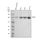 ITPKC Antibody by WB in MDA-MB-453, RT4, U251 and Caco-2 cells. Western blot analysis of human whole-cell lysates using rabbit polyclonal ITPKC Antibody. Lane 1: MDA-MB-453; lane 2: RT4; lane 3: U251; lane 4: Caco-2. Samples were separated by 8% SDS-PAGE under reducing conditions, with 30 ug loaded per lane. A prominent band is detected at approximately 100-105 kDa in all four samples, compared with the calculated molecular weight of 75 kDa. A similar apparent molecular weight has been reported in independent ITPKC antibody validation, although the reason for the higher-than-predicted migration remains unestablished. Additional weaker bands are visible in U251 and Caco-2. This Inositol Trisphosphate 3-Kinase C Polyclonal Antibody was used at 0.5 ug/ml.