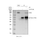 ITPKC Antibody by IP and WB in RT4 cells. Immunoprecipitation of ITPKC from human RT4 whole-cell lysate using rabbit polyclonal ITPKC Antibody, followed by western blot detection. Lane 1: RT4 input lysate (30 ug); lane 2: rabbit control IgG IP; lane 3: IP using 2 ug of ITPKC antibody with 500 ug of RT4 lysate. Western blot detection was performed separately using the same antibody at 0.5 ug/ml. A band near 100-105 kDa is detected in the input and antibody IP lanes but is absent from the control IgG lane, supporting antibody-dependent enrichment. Prominent bands near 45-50 kDa correspond to IgG heavy chains. This Inositol Trisphosphate 3-Kinase C Polyclonal Antibody demonstrates IP activity under the tested conditions.
