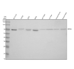 DTNB Antibody Human Mouse Rat WB. Western blot analysis of 1) human SH-SY5Y, 2) human Jurkat, 3) human 293T, 4) human SiHa, 5) rat brain, 6) rat liver, 7) mouse brain, and 8) mouse liver lysates using DTNB antibody. A prominent immunoreactive band is detected at approximately 66-70 kDa, consistent with the expected molecular weight range of Dystrobrevin Beta (DTNB). Human cell lysates exhibit a closely spaced doublet near 70 kDa, which may reflect alternatively spliced isoforms or post-translationally modified forms of DTNB. In contrast, rat and mouse tissue lysates predominantly display a single major band corresponding to the conserved DTNB protein. Dystrobrevin Beta is a component of the dystrophin-associated protein complex involved in cytoskeletal organization, membrane stability, and intracellular signaling. The observed cross-species reactivity supports the utility of this DTNB antibody for western blot detection of endogenous DTNB expression in both human and rodent samples. Predicted molecular weight: ~66-70 kDa.