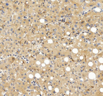 Immunohistochemical staining of FGL1 using anti-FGL1 antibody. FGL1 was detected in a paraffin-embedded section of human liver tissue. Heat mediated antigen retrieval was performed in EDTA buffer (pH 8.0, epitope retrieval solution). The tissue section was blocked with 10% goat serum. The tissue section was then incubated with 2 ug/ml rabbit anti-FGL1 antibody overnight at 4oC. Peroxidase Conjugated Goat Anti-rabbit IgG was used as secondary antibody and incubated for 30 minutes at 37oC. The tissue section was developed using an HRP secondary and DAB substrate.