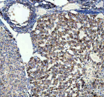 Immunohistochemical staining of STRIP1 using anti-STRIP1 antibody. STRIP1 was detected in a paraffin-embedded section of mouse ovary tissue. Heat mediated antigen retrieval was performed in EDTA buffer (pH 8.0, epitope retrieval solution). The tissue section was blocked with 10% goat serum. The tissue section was then incubated with 2 ug/ml rabbit anti-STRIP1 antibody overnight at 4oC. Peroxidase Conjugated Goat Anti-rabbit IgG was used as secondary antibody and incubated for 30 minutes at 37oC. The tissue section was developed using an HRP secondary and DAB substrate.