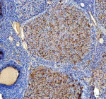 Immunohistochemical staining of STRIP1 using anti-STRIP1 antibody. STRIP1 was detected in a paraffin-embedded section of rat ovary tissue. Heat mediated antigen retrieval was performed in EDTA buffer (pH 8.0, epitope retrieval solution). The tissue section was blocked with 10% goat serum. The tissue section was then incubated with 2 ug/ml rabbit anti-STRIP1 antibody overnight at 4oC. Peroxidase Conjugated Goat Anti-rabbit IgG was used as secondary antibody and incubated for 30 minutes at 37oC. The tissue section was developed using an HRP secondary and DAB substrate.