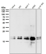 DUT Antibody Human Cell Line WB. Western blot analysis of HeLa, 293, MCF7, K562, and U-87 MG cell lysates using Deoxyuridine Triphosphatase / DUT Antibody demonstrates detection of DUT isoforms within the expected molecular weight range. Deoxyuridine Triphosphatase (DUT) is a nucleotide metabolism enzyme that regulates intracellular dUTP pools and protects genomic DNA from inappropriate uracil incorporation during replication. The predominant signal is observed at approximately 18-21 kDa, consistent with the mature nuclear/cytosolic DUT isoform, while higher molecular weight species corresponding to the mitochondrial precursor isoform may also be detected. The lower molecular weight isoform can appear as a doublet, reflecting post-translational modification and processing events associated with DUT maturation. Western blot was performed using a 1:5000 dilution of primary antibody. Predicted molecular weights: ~24-27 kDa (mitochondrial isoform) and ~18-21 kDa (nuclear/cytosolic isoform).