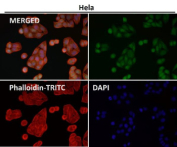 DUT Antibody HeLa IF. Immunofluorescent staining of HeLa cells using Deoxyuridine Triphosphatase / DUT Antibody demonstrates prominent nuclear localization of DUT (green), consistent with the expected distribution of the mature nuclear isoform responsible for regulating intracellular dUTP pools during DNA replication. DUT is a genome integrity enzyme that prevents inappropriate uracil incorporation into DNA and supports replication fidelity through maintenance of nucleotide homeostasis. Phalloidin-TRITC staining (red) highlights the actin cytoskeleton, while DAPI (blue) identifies cell nuclei. The observed nuclear staining pattern is consistent with the established role of DUT in nucleotide metabolism, DNA integrity, and genome maintenance pathways. Immunofluorescent staining was performed using DUT antibody at a 1:50 dilution.