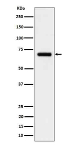 Western blot analysis of CD125/IL5RA in human serum cell lysate using IL5RA antibody. Predicted molecular weight ~47 kDa but may be observed at higher molecular weights due to glycosylation.