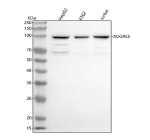 ADGRE5 Antibody WB. Western blot analysis of ADGRE5 using anti-ADGRE5 antibody. Lane 1: human HepG2 whole cell lysates, Lane 2: human K562 whole cell lysates, Lane 3: human Jurkat whole cell lysates. After electrophoresis, proteins were transferred to a nitrocellulose membrane at 150 mA for 50-90 minutes. Blocked the membrane with 5% non-fat milk/TBS for 1.5 hour at RT. The membrane was incubated with rabbit anti-ADGRE5 antibody at 0.5 ug/ml overnight at 4oC, then washed with TBS-0.1%Tween 3 times with 5 minutes each and probed with a goat anti-rabbit IgG-HRP secondary antibody at a dilution of 1:5000 for 1.5 hour at RT. The signal was developed using enhanced chemiluminescent. A predominant band is observed near ~100 kDa, consistent with the glycosylated, autoproteolytically processed form of CD97. Minor lower-migrating species may represent less glycosylated or precursor forms of the receptor.