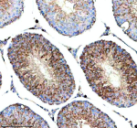 Immunohistochemical staining of HERC4 using anti-HERC4 antibody. HERC4 was detected in a paraffin-embedded section of rat testis tissue. Heat mediated antigen retrieval was performed in EDTA buffer (pH 8.0, epitope retrieval solution). The tissue section was blocked with 10% goat serum. The tissue section was then incubated with 2 ug/ml rabbit anti-HERC4 antibody overnight at 4oC. Peroxidase Conjugated Goat Anti-rabbit IgG was used as secondary antibody and incubated for 30 minutes at 37oC. The tissue section was developed using an HRP secondary and DAB substrate.