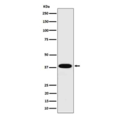 Western blot analysis of Cathepsin H in HepG2 cell lysate using CTSH antibody. Predicted molecular weight ~37 kDa.