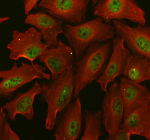 Immunofluorescent staining of PSME3 using anti-PSME3 antibody (green) and anti-Tubulin Alpha antibody (red). PSME3 was detected in immunocytochemical section of U2OS cell. Enzyme antigen retrieval was performed using IHC enzyme antigen retrieval reagent for 15 mins. The cells were blocked with 10% goat serum. And then incubated with 5 ug/ml rabbit anti-PSME3 antibody and mouse anti-Tubulin Alpha antibody overnight at 4oC. DyLight 488 Conjugated Goat Anti-Rabbit IgG and Cy3 Conjugated Goat Anti-Mouse IgG were used as secondary antibody at 1:500 dilution and incubated for 30 minutes at 37oC. Visualize using a fluorescence microscope and filter sets appropriate for the label used.