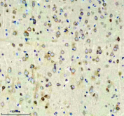 Immunohistochemical staining of RIM1/RIMS1 using anti-RIMS1 antibody. RIM1/RIMS1 was detected in a paraffin-embedded section of mouse brain tissue. Heat mediated antigen retrieval was performed in EDTA buffer (pH 8.0, epitope retrieval solution). The tissue section was blocked with 10% goat serum. The tissue section was then incubated with 2 ug/ml rabbit anti-RIMS1 antibody overnight at 4oC. Peroxidase Conjugated Goat Anti-rabbit IgG was used as secondary antibody and incubated for 30 minutes at 37oC. The tissue section was developed using an HRP secondary and DAB substrate.