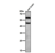 Rat brain tissue lysate tested with the Phospho-CaMKII alpha (pT286) antibody at 1:2000 dilution for 1 hour at room temperature.