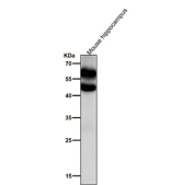 Mouse brain tissue lysate tested with the Phospho-CaMKII alpha (pT286) antibody at 1:2000 dilution for 1 hour at room temperature. Phospho-CaMKII western of mouse hippocampus using pT286 antibody shows a ~50 kDa band (CaMKII alpha) and a ~60 kDa band (possible cross-reactive CaMKII beta pT287), consistent with isoform expression in hippocampus and phosphorylation-dependent mobility shifts.