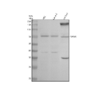 Western blot analysis of Twinkle/TWNK using anti-TWNK antibody. Electrophoresis was performed on a 10% SDS-PAGE gel at 80V (Stacking gel) / 120V (Resolving gel) for 2 hours. Lane 1: human HEL whole cell lysates, Lane 2: human Caco-2 whole cell lysates, Lane 3: rat liver tissue lysates. After electrophoresis, proteins were transferred to a nitrocellulose membrane at 150 mA for 50-90 minutes. Blocked the membrane with 5% non-fat milk/TBS for 1.5 hour at RT. The membrane was incubated with rabbit anti-TWNK antibody at 0.5 ug/ml overnight at 4oC, then washed with TBS-0.1%Tween 3 times with 5 minutes each and probed with a goat anti-rabbit IgG-HRP secondary antibody at a dilution of 1:5000 for 1.5 hour at RT. The signal was developed using an ECL Plus Western Blotting Substrate. The expected molecular weight of Twinkle/TWNK is at ~77 kDa.