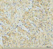 Immunohistochemical staining of SNCA using anti-SNCA antibody. SNCA was detected in a paraffin-embedded section of mouse brain tissue. Heat mediated antigen retrieval was performed in EDTA buffer (pH 8.0, epitope retrieval solution). The tissue section was blocked with 10% goat serum. The tissue section was then incubated with 2 ug/ml rabbit anti-SNCA antibody overnight at 4oC. Peroxidase Conjugated Goat Anti-rabbit IgG was used as secondary antibody and incubated for 30 minutes at 37oC. The tissue section was developed using an HRP secondary and DAB substrate.