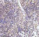 Immunohistochemical staining of RBM42 using anti-RBM42 antibody. RBM42 was detected in a paraffin-embedded section of human spleen tissue. Heat mediated antigen retrieval was performed in EDTA buffer (pH 8.0, epitope retrieval solution). The tissue section was blocked with 10% goat serum. The tissue section was then incubated with 2 ug/ml rabbit anti-RBM42 antibody overnight at 4oC. Peroxidase Conjugated Goat Anti-rabbit IgG was used as secondary antibody and incubated for 30 minutes at 37oC. The tissue section was developed using an HRP secondary and DAB substrate.