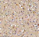 Immunohistochemical staining of FUNDC1 using anti-FUNDC1 antibody. FUNDC1 was detected in a paraffin-embedded section of mouse midbrain tissue. Heat mediated antigen retrieval was performed in EDTA buffer (pH 8.0, epitope retrieval solution). The tissue section was blocked with 10% goat serum. The tissue section was then incubated with 2 ug/ml rabbit anti-FUNDC1 antibody overnight at 4oC. Peroxidase Conjugated Goat Anti-rabbit IgG was used as secondary antibody and incubated for 30 minutes at 37oC. The tissue section was developed using an HRP secondary and DAB substrate.