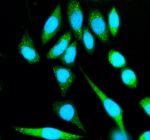 Immunofluorescent staining of SHE using anti-SHE antibody (green). SHE was detected in an immunocytochemical section of SIHA cells. Enzyme antigen retrieval was performed using IHC enzyme antigen retrieval reagent for 15 mins. The cells were blocked with 10% goat serum. And then incubated with 5 ug/ml rabbit anti-SHE antibody overnight at 4oC. DyLight 488 Conjugated Goat Anti-Rabbit IgG was used as secondary antibody at 1:500 dilution and incubated for 30 minutes at 37oC. The section was counterstained with DAPI nuclear stain (blue). Visualize using a fluorescence microscope and filter sets appropriate for the label used.