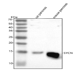 Western blot analysis of SYCN using anti-SYCN antibody. Lane 1: rat pancreas tissue lysates, Lane 2: mouse pancreas tissue lysates. After electrophoresis, proteins were transferred to a nitrocellulose membrane at 150 mA for 50-90 minutes. Blocked the membrane with 5% non-fat milk/TBS for 1.5 hour at RT. The membrane was incubated with rabbit anti-SYCN antibody at 0.5 ug/ml overnight at 4oC, then washed with TBS-0.1%Tween 3 times with 5 minutes each and probed with a goat anti-rabbit IgG-HRP secondary antibody at a dilution of 1:5000 for 1.5 hour at RT. The signal was developed using enhanced chemiluminescent. A specific band was detected for SYCN at approximately 14 kDa. The expected molecular weight of SYCN is ~14 kDa.