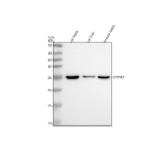 Western blot analysis of GSTM2 using anti-GSTM2 antibody. Electrophoresis was performed on a 12% SDS-PAGE gel at 80V (Stacking gel) / 120V (Resolving gel) for 2 hours. Lane 1: rat testis tissue lysates, Lane 2: rat liver tissue lysates, Lane 3: mouse testis tissue lysates. After electrophoresis, proteins were transferred to a nitrocellulose membrane at 150 mA for 50-90 minutes. Blocked the membrane with 5% non-fat milk/TBS for 1.5 hour at RT. The membrane was incubated with rabbit anti-GSTM2 antibody at 0.5 ug/ml overnight at 4oC, then washed with TBS-0.1%Tween 3 times with 5 minutes each and probed with a goat anti-rabbit IgG-HRP secondary antibody at a dilution of 1:5000 for 1.5 hour at RT. The signal was developed using an ECL Plus Western Blotting Substrate. A specific band was detected for GSTM2 at approximately 26 kDa. The expected molecular weight of GSTM2 is ~26 kDa.