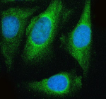 Immunofluorescent staining of NDUFB11 using anti-NDUFB11 antibody (green). NDUFB11 was detected in an immunocytochemical section of HELA cells. Enzyme antigen retrieval was performed using IHC enzyme antigen retrieval reagent for 15 mins. The cells were blocked with 10% goat serum. And then incubated with 5 ug/ml rabbit anti-NDUFB11 antibody overnight at 4oC. DyLight 488 Conjugated Goat Anti-Rabbit IgG was used as secondary antibody at 1:500 dilution and incubated for 30 minutes at 37oC. The section was counterstained with DAPI nuclear stain (blue). Visualize using a fluorescence microscope and filter sets appropriate for the label used.
