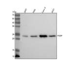 Western blot analysis of PUDP using anti-PUDP antibody. Lane 1: human 293T whole cell lysates, Lane 2: human Hela whole cell lysates, Lane 3: human Caco-2 whole cell lysates, Lane 4: human whole cell lysates. After electrophoresis, proteins were transferred to a nitrocellulose membrane at 150 mA for 50-90 minutes. Blocked the membrane with 5% non-fat milk/TBS for 1.5 hour at RT. The membrane was incubated with rabbit anti-PUDP antibody at 0.5 ug/ml overnight at 4oC, then washed with TBS-0.1%Tween 3 times with 5 minutes each and probed with a goat anti-rabbit IgG-HRP secondary antibody at a dilution of 1:5000 for 1.5 hour at RT. The signal was developed using enhanced chemiluminescent. A specific band was detected for PUDP at approximately 25 kDa. The expected molecular weight of PUDP is ~25 kDa.