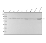Western blot analysis of SLC27A2 using anti-SLC27A2 antibody. Electrophoresis was performed on a 10% SDS-PAGE gel at 80V (Stacking gel) / 120V (Resolving gel) for 2 hours. Lane 1: human Hacat whole cell lysates, Lane 2: human HEL whole cell lysates, Lane 3: human whole cell lysates, Lane 4: human Hela whole cell lysates, Lane 5: rat liver tissue lysates, Lane 6: rat kidney tissue lysates, Lane 7: mouse liver tissue lysates, Lane 8: mouse kidney tissue lysates. After electrophoresis, proteins were transferred to a nitrocellulose membrane at 150 mA for 50-90 minutes. Blocked the membrane with 5% non-fat milk/TBS for 1.5 hour at RT. The membrane was incubated with rabbit anti-SLC27A2 antibody at 1: 1000 overnight at 4oC, then washed with TBS-0.1%Tween 3 times with 5 minutes each and probed with a goat anti-rabbit IgG-HRP secondary antibody at a dilution of 1:5000 for 1.5 hour at RT. The signal was developed using an ECL Plus Western Blotting Substrate. A specific band was detected for SLC27A2 at approximately 70 kDa. The expected molecular weight of SLC27A2 is ~70 kDa.