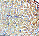 Immunohistochemical staining of SLC27A2 using anti-SLC27A2 antibody. SLC27A2 was detected in a paraffin-embedded section of human liver tissue. Heat mediated antigen retrieval was performed in EDTA buffer (pH 8.0, epitope retrieval solution). The tissue section was blocked with 10% goat serum. The tissue section was then incubated with 2 ug/ml rabbit anti-SLC27A2 antibody overnight at 4oC. Peroxidase Conjugated Goat Anti-rabbit IgG was used as secondary antibody and incubated for 30 minutes at 37oC. The tissue section was developed using an HRP secondary and DAB substrate.
