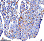 Immunohistochemical staining of CTRC using anti-CTRC antibody. CTRC was detected in a paraffin-embedded section of rat pancreas tissue. Heat mediated antigen retrieval was performed in EDTA buffer (pH 8.0, epitope retrieval solution). The tissue section was blocked with 10% goat serum. The tissue section was then incubated with 2 ug/ml rabbit anti-CTRC antibody overnight at 4oC. Peroxidase Conjugated Goat Anti-rabbit IgG was used as secondary antibody and incubated for 30 minutes at 37oC. The tissue section was developed using an HRP secondary and DAB substrate.