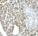 Immunohistochemical staining of CTRC using anti-CTRC antibody. CTRC was detected in a paraffin-embedded section of human pancreas tissue. Heat mediated antigen retrieval was performed in EDTA buffer (pH 8.0, epitope retrieval solution). The tissue section was blocked with 10% goat serum. The tissue section was then incubated with 2 ug/ml rabbit anti-CTRC antibody overnight at 4oC. Peroxidase Conjugated Goat Anti-rabbit IgG was used as secondary antibody and incubated for 30 minutes at 37oC. The tissue section was developed using an HRP secondary and DAB substrate.