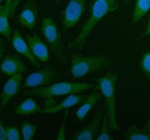 Immunofluorescent staining of using anti-ARL2 antibody (green). ARL2 was detected in an immunocytochemical section of human HELA cells. Enzyme antigen retrieval was performed using IHC enzyme antigen retrieval reagent for 15 mins. The cells were blocked with 10% goat serum. And then incubated with 5 ug/ml rabbit anti-ARL2 antibody overnight at 4oC. DyLight 488 Conjugated Goat Anti-Rabbit IgG was used as secondary antibody at 1:500 dilution and incubated for 30 minutes at 37oC. The section was counterstained with DAPI nuclear stain (blue). Visualize using a fluorescence microscope and filter sets appropriate for the label used.
