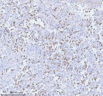 Immunohistochemical staining of PCYOX1 using anti-PCYOX1 antibody. PCYOX1 was detected in a paraffin-embedded section of human testicular seminoma tissue. Heat mediated antigen retrieval was performed in EDTA buffer (pH 8.0, epitope retrieval solution). The tissue section was blocked with 10% goat serum. The tissue section was then incubated with 2 ug/ml rabbit anti-PCYOX1 antibody overnight at 4oC. Peroxidase Conjugated Goat Anti-rabbit IgG was used as secondary antibody and incubated for 30 minutes at 37oC. The tissue section was developed using an HRP secondary and DAB substrate.