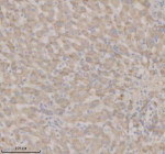 Immunohistochemical staining of SHD using anti-SHD antibody. SHD was detected in a paraffin-embedded section of human liver tissue. Heat mediated antigen retrieval was performed in EDTA buffer (pH 8.0, epitope retrieval solution). The tissue section was blocked with 10% goat serum. The tissue section was then incubated with 2 ug/ml rabbit anti-SHD antibody overnight at 4oC. Peroxidase Conjugated Goat Anti-rabbit IgG was used as secondary antibody and incubated for 30 minutes at 37oC. The tissue section was developed using an HRP secondary and DAB substrate.